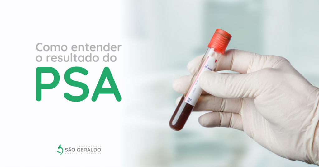 psa 1 ng/ml tumori din prostatită